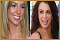 What’s Up with Britney Spears’ Smile? The Scoop on Her Noticeable Gap Teeth